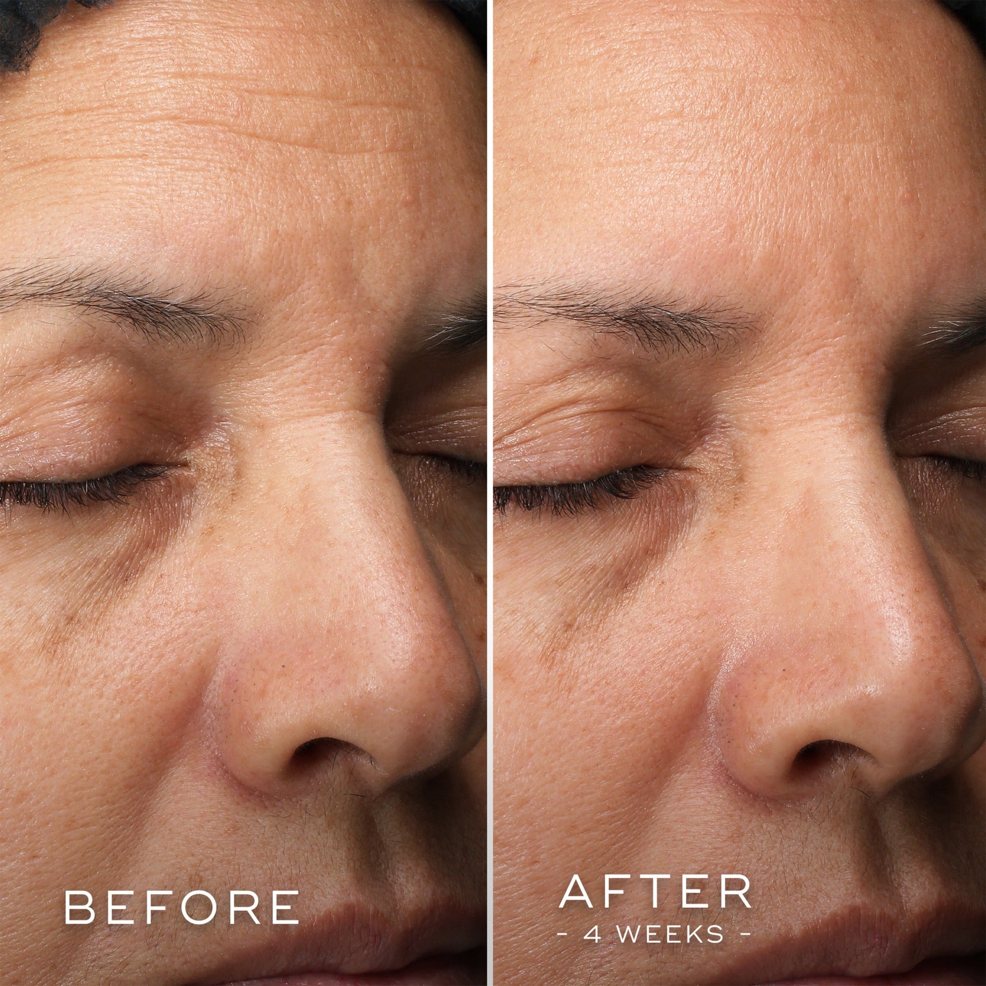 C-TETRA® Luxe MEDIK8 Official Stockist. Worldwide shipping. Medical-grade skincare. The M-ethod Aesthetics