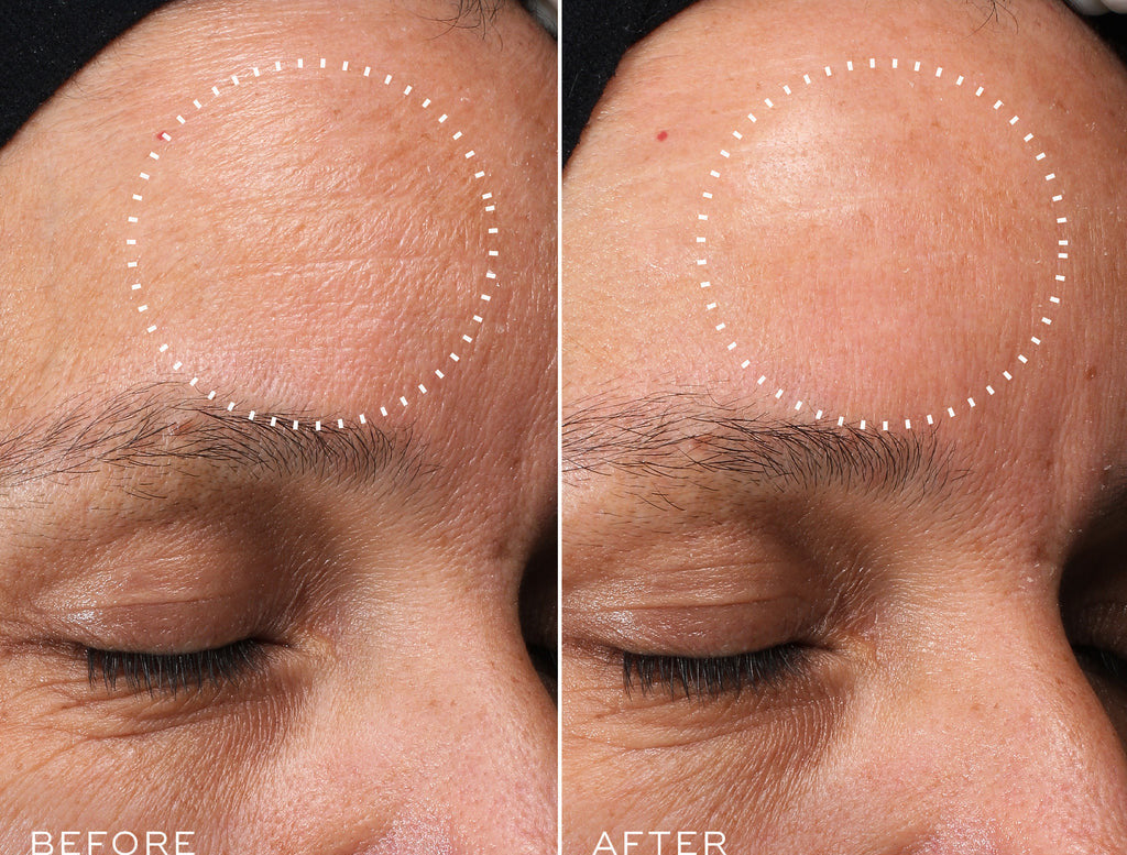 H.E.O Mask. MEDIK8 Official Stockist. Worldwide shipping. Medical-grade skincare. The M-ethod Aesthetics