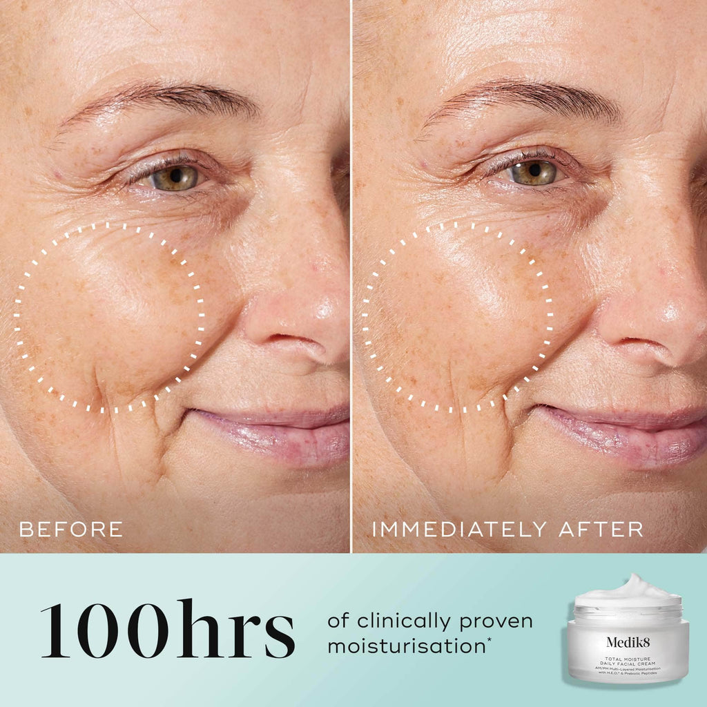 Total Moisture Cream texture by Medik8— before and after showing clinically proven nmoisturisation.