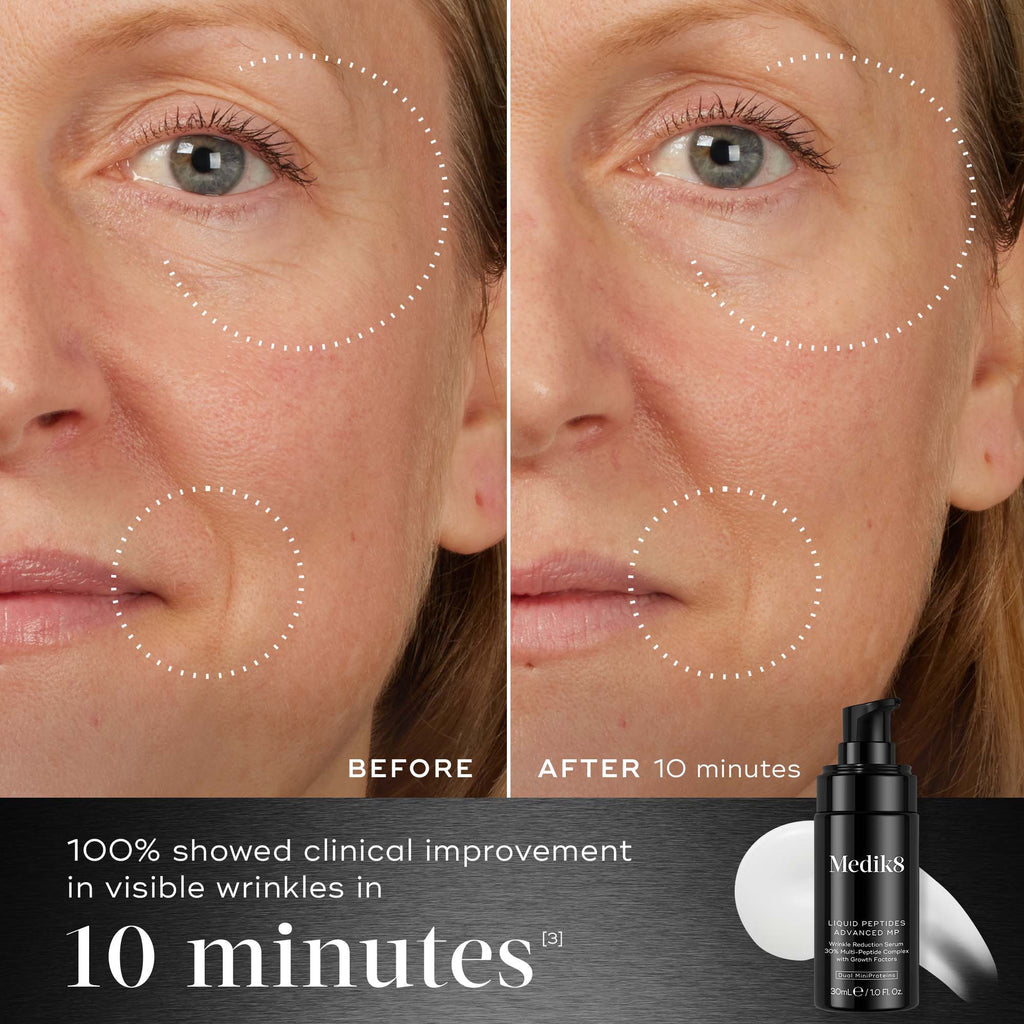 Before and after comparison of a woman's face with visible wrinkles, showing clinical improvement with Medik8's Liquid Pptides Advanced MP.