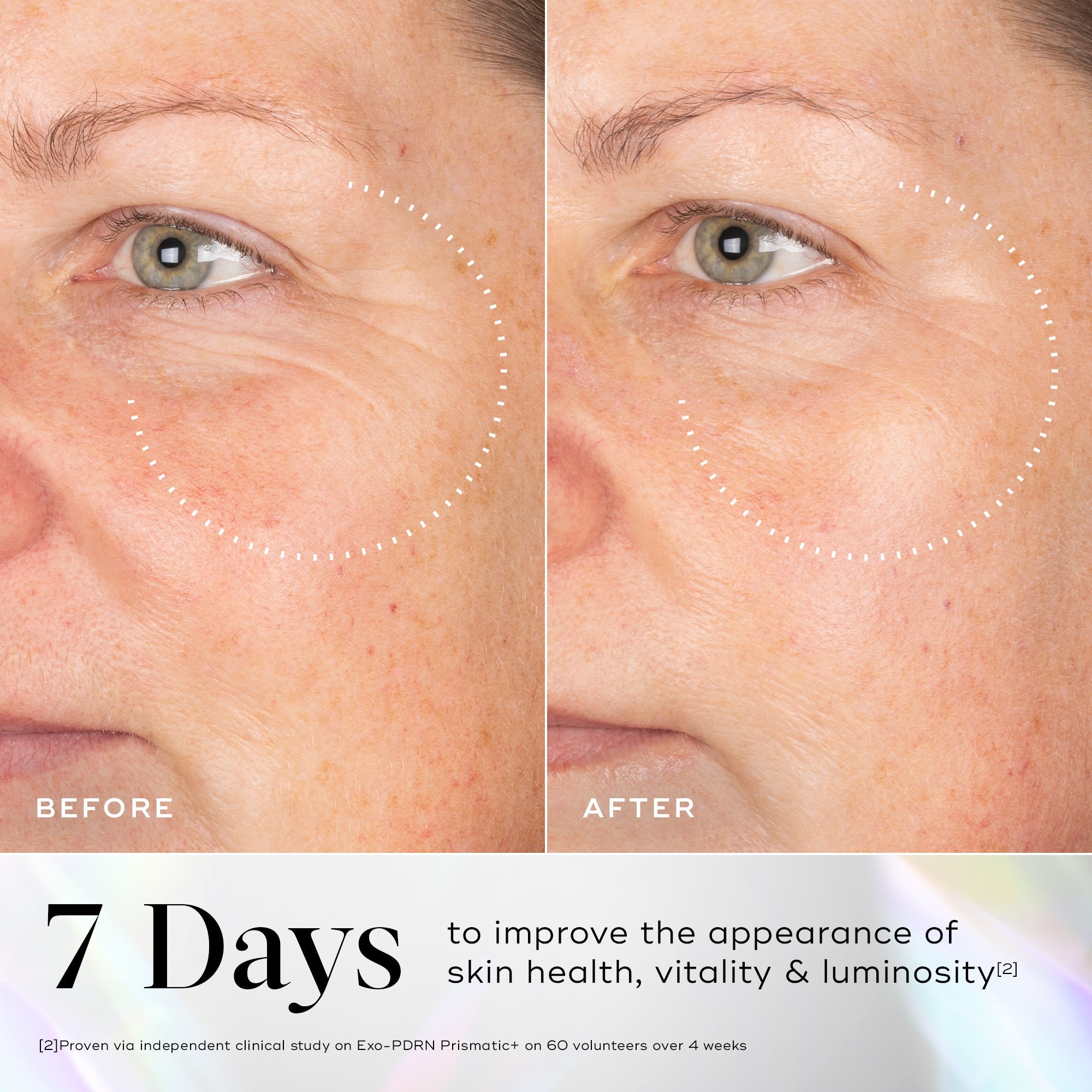 Before and after Medik8 Exo-PDRN Prismatic+ serum comparison of skin health improvement with text indicating 7 days to achieve better appearance.