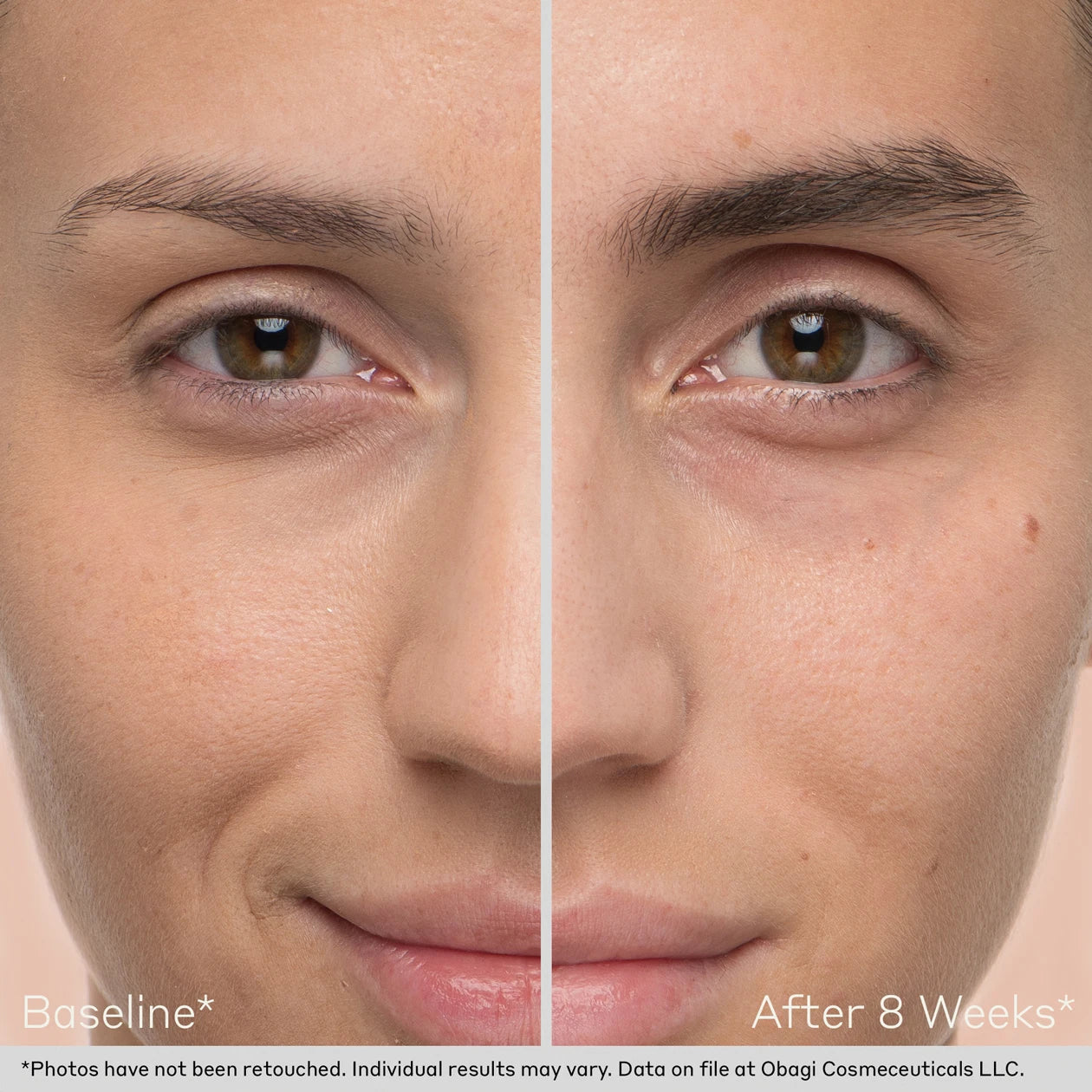 Nu-Cil Value Kit (Limited 2025 Edition)