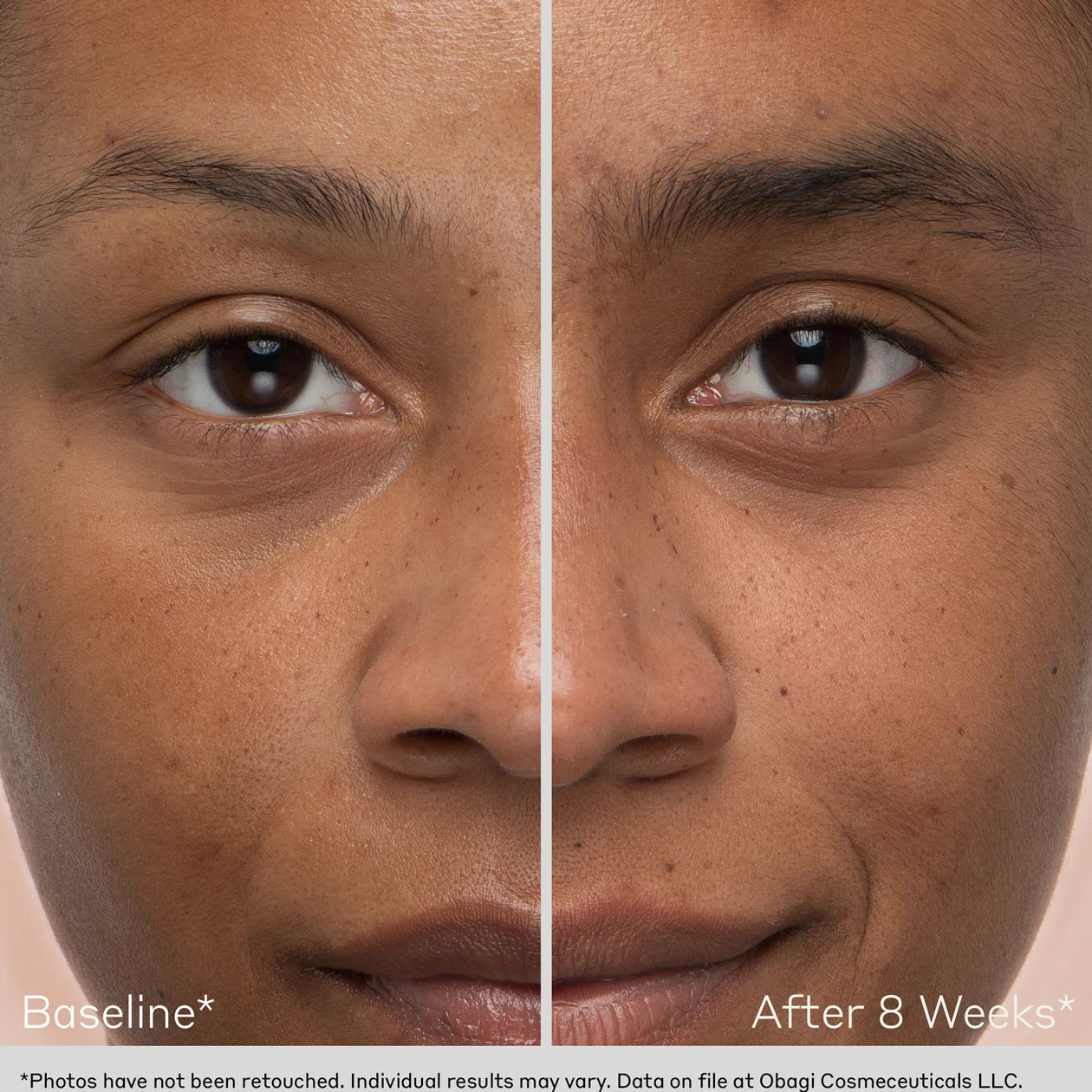 Nu-Cil Value Kit (Limited 2025 Edition)