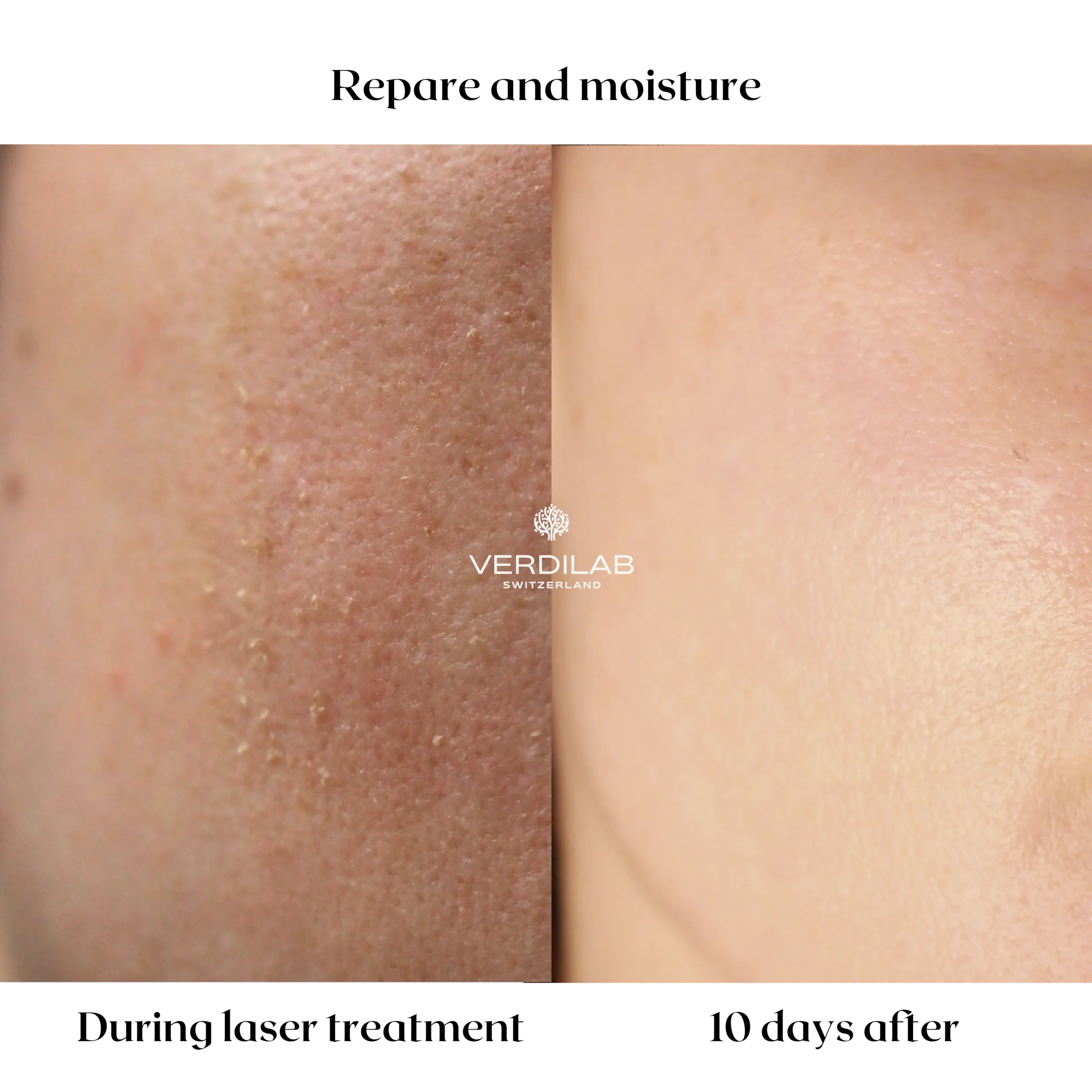 Verdilab Detox Mask before after—natural replenishing mask with ImmunatuRNA® and marine actives.