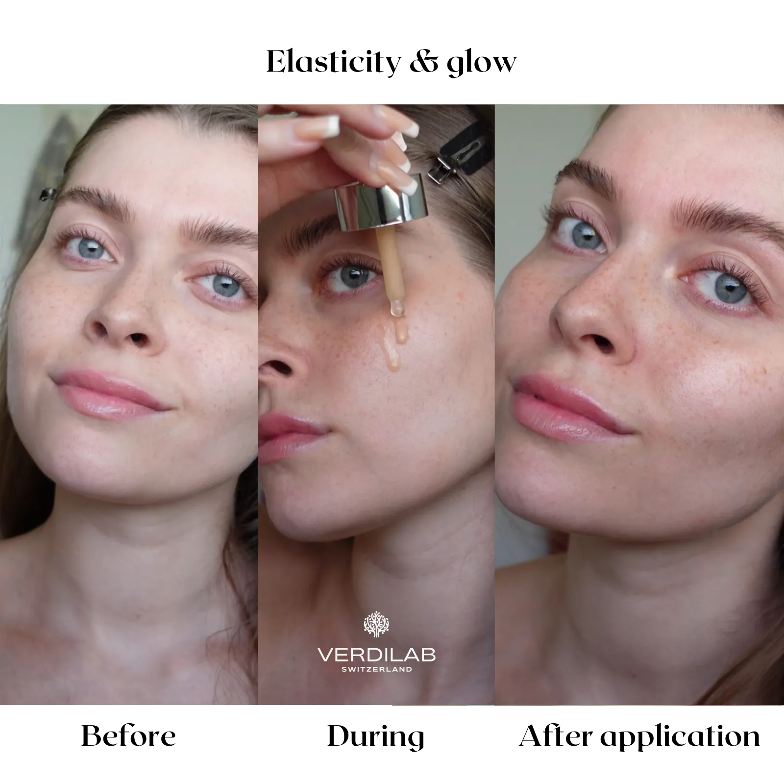 Verdilab Lift & Glow Rose Serum before/after—rose-powered serum for hydration and elasticity.