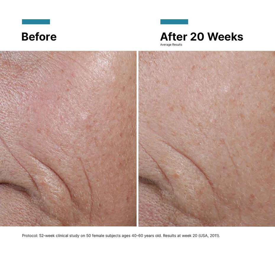 Before/after 12 weeks using CE Ferulic—improved firmness, brightness, reduced lines.