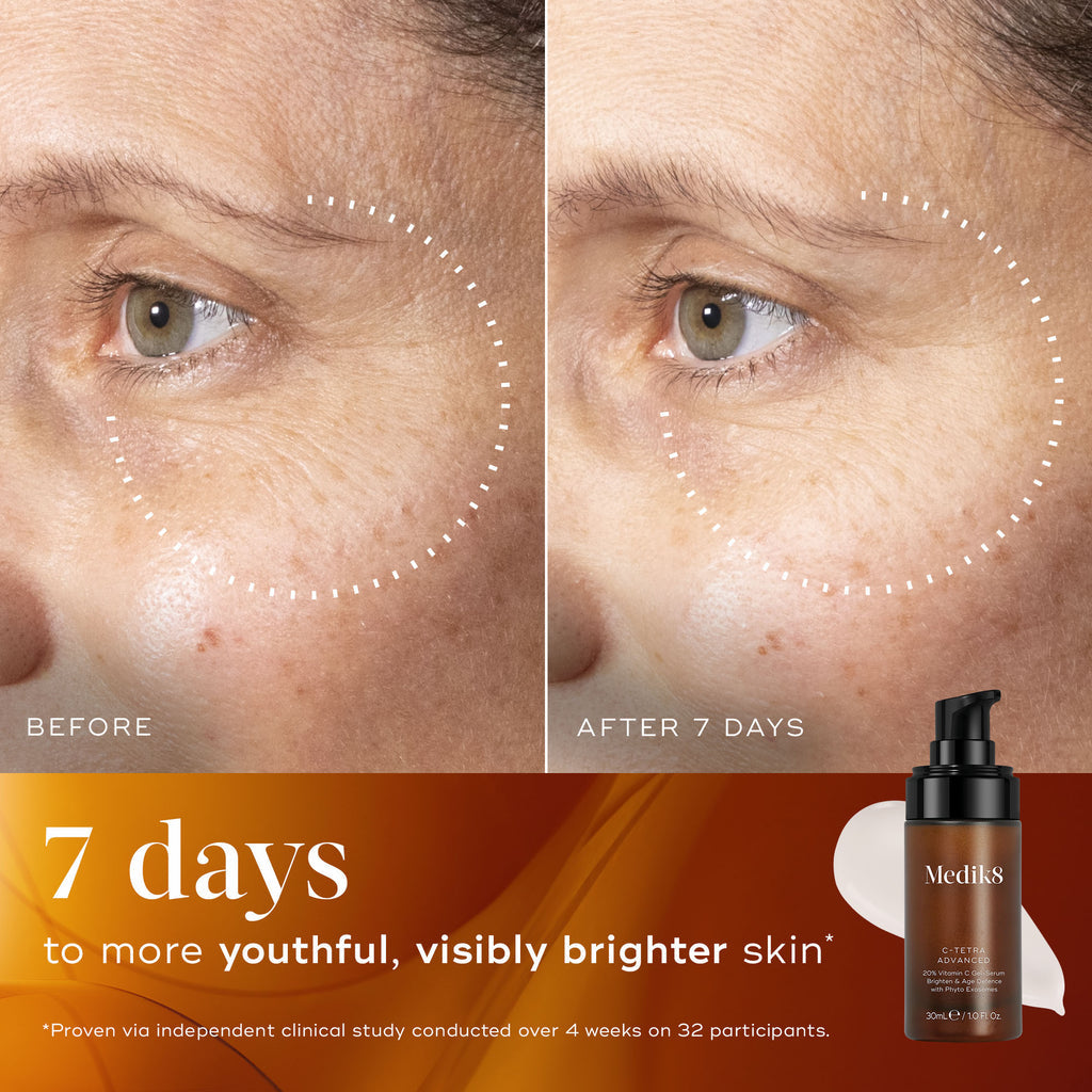Before and after comparison of skin with a Medik8 C-Tetra Advanced in 7 days showing visible improvement.