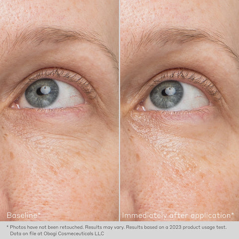 Obagi Daily Hydro-Drops Rejuvenating Eye Gel Cream applied to under-eye area, before and after, delivering intense hydration and a luminous, awake appearance.