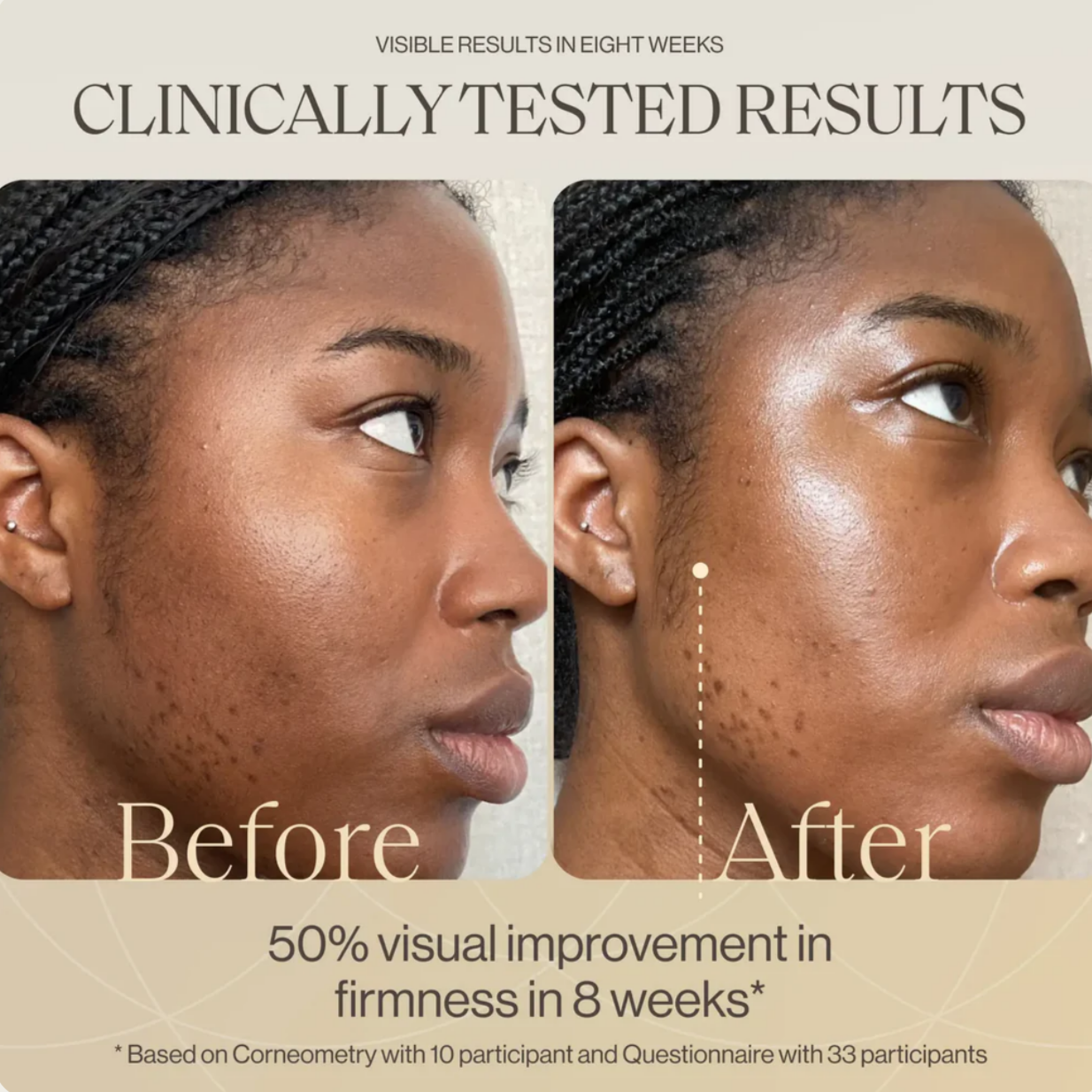 IRÄYE The Cream—anti-ageing face cream with LYMPHACTIVE™ Complex and vitamin C.