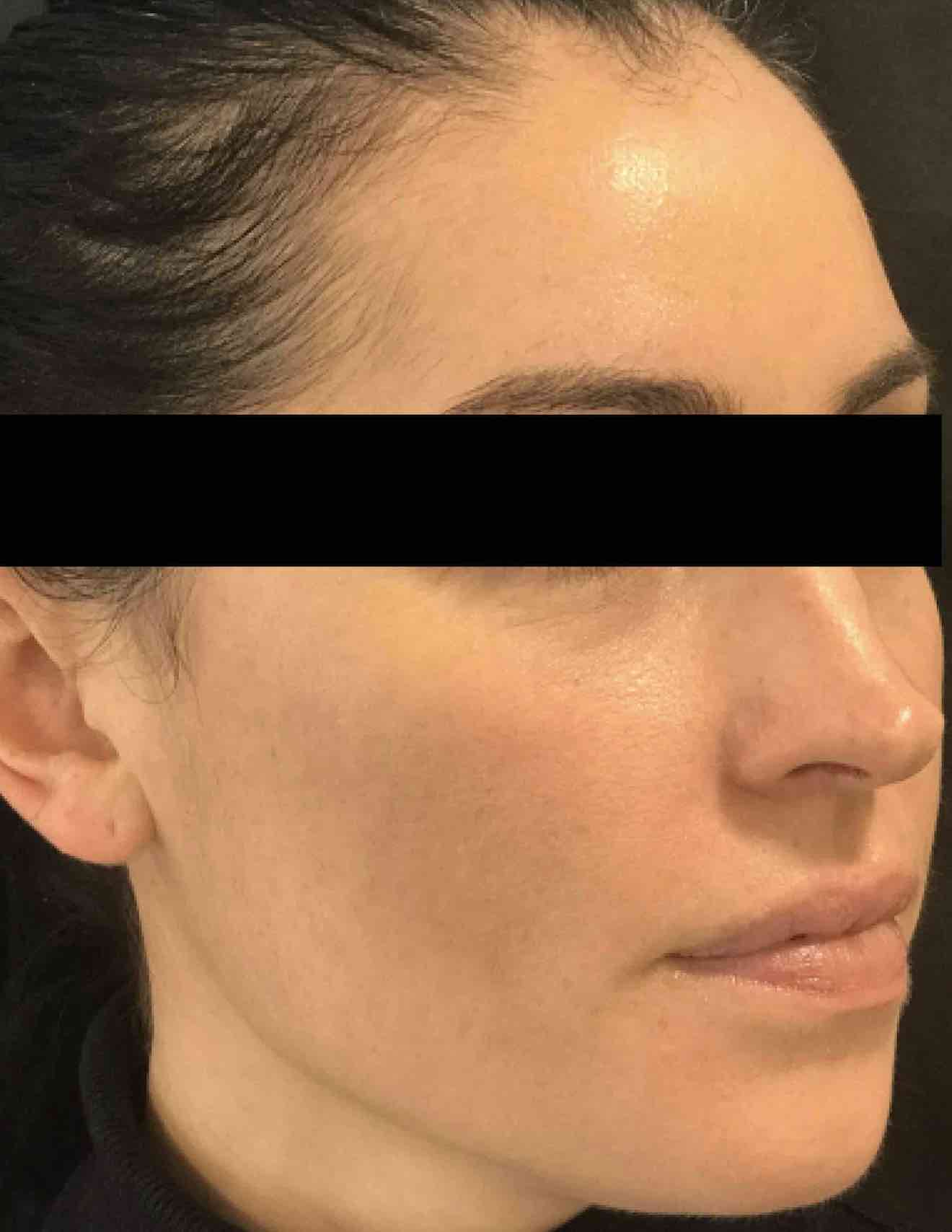 Woman showing off her skin after medical-grade skincare treatments