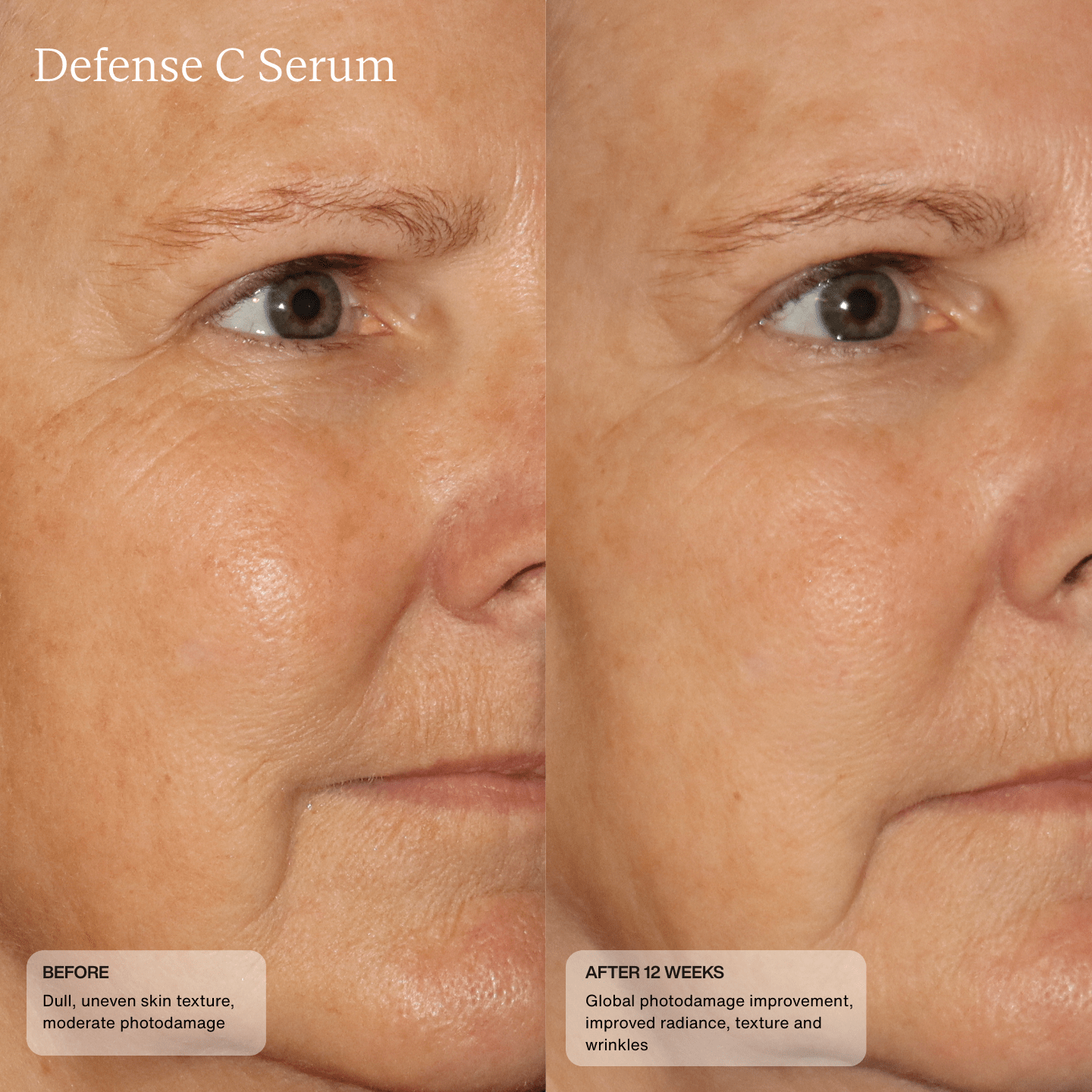Close-up before and after of cheeks with Sente Defense C Serum—calmer, smoother, more even skin with enhanced barrier resilience.