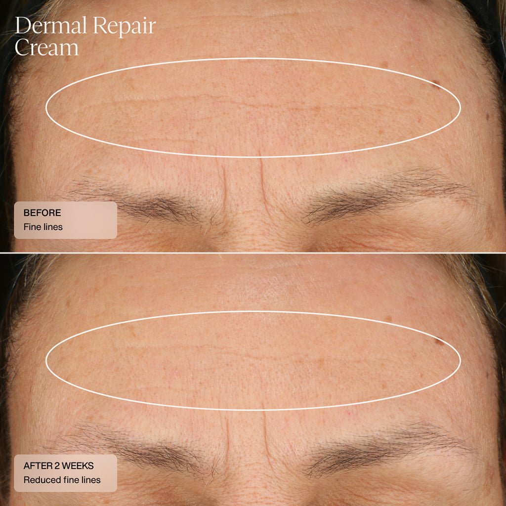 Senté Dermal Repair Cream before and after—nourished, smoother skin with reduced dryness.