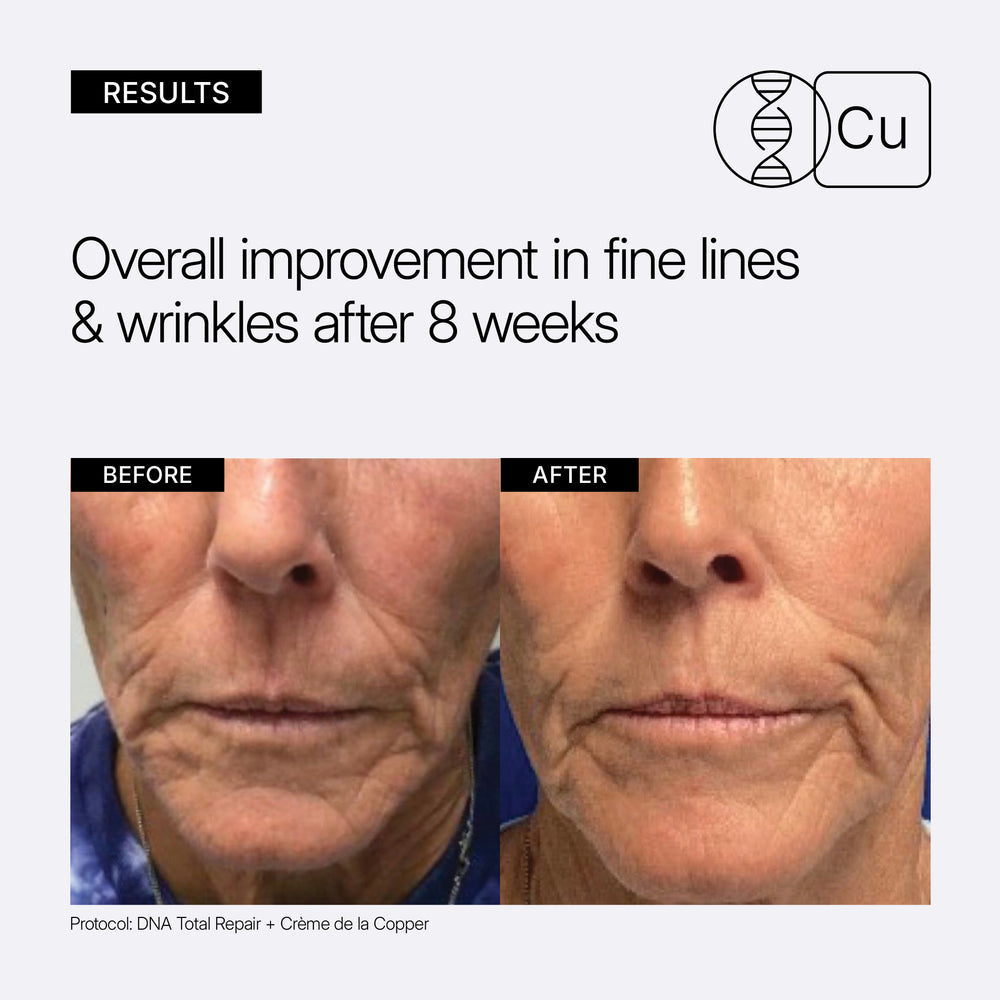 Before and after comparison of skin improvement with text indicating results after 8 weeks. NEOVA Crème de la Copper with DNA repair enzymes and copper peptide complex for photodamaged skin.