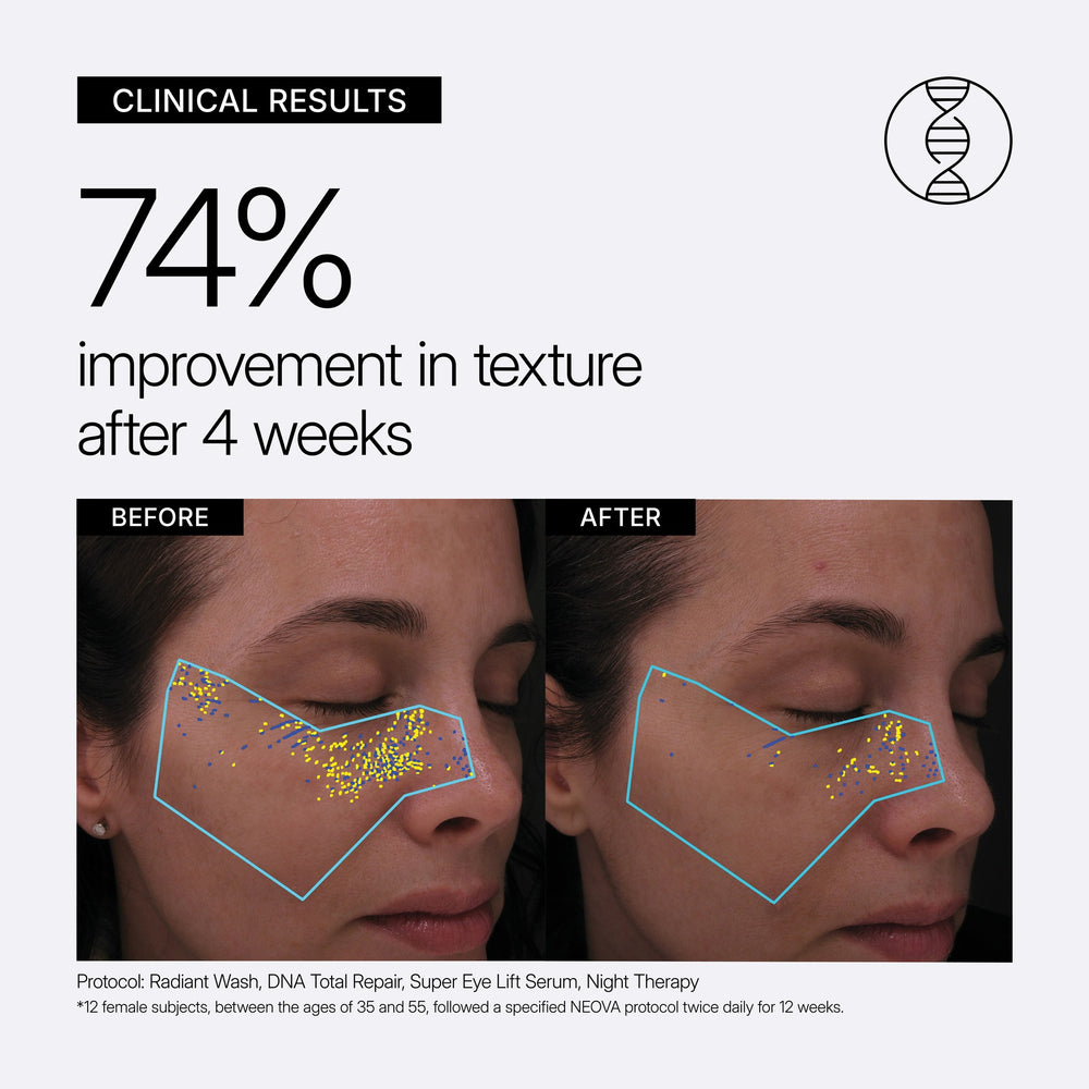 Clinical results graphic with DNA Total Repair and Night Therapy showing a 74% improvement in texture after 4 weeks, with before-and-after facial skin close-ups of a woman's cheek and eye area, plus protocol text at the bottom.
