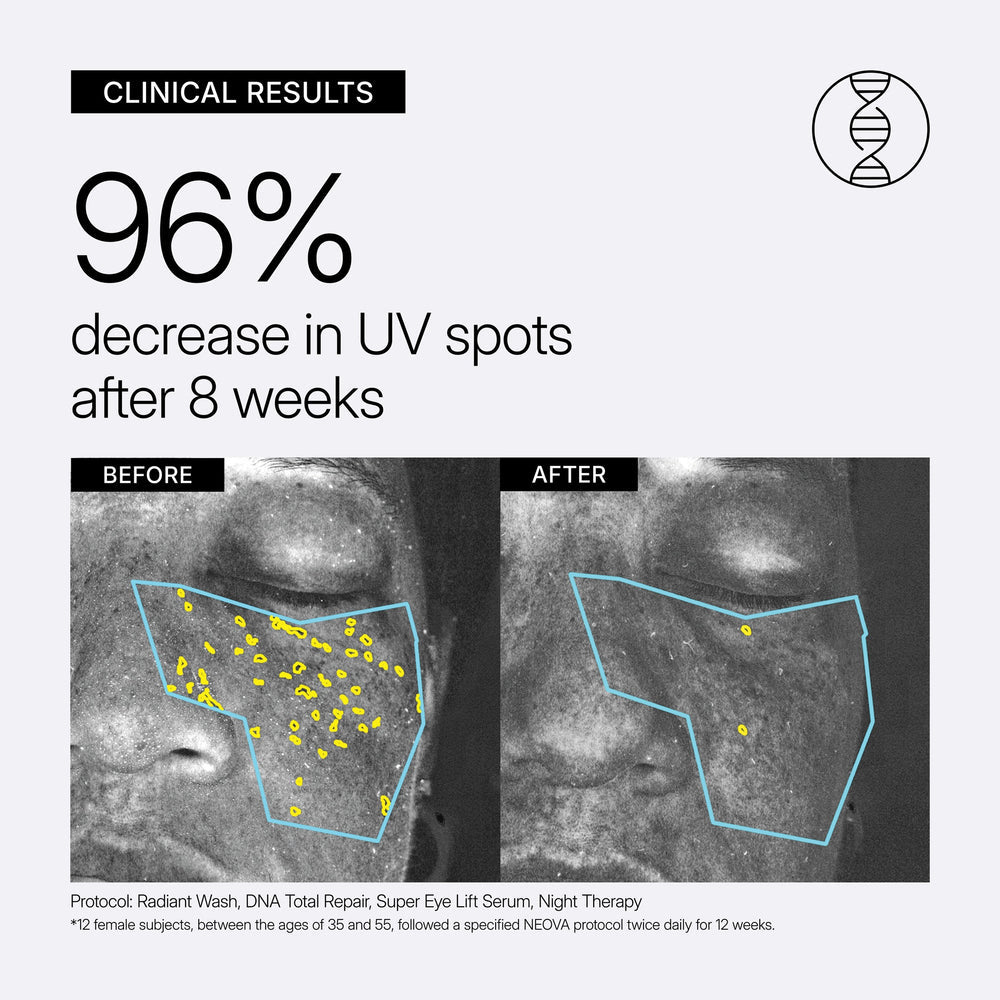 Advertisement showing clinical results of Neova DNA Total Repair and Night Therapy protocol with before and after images of UV spots on skin.