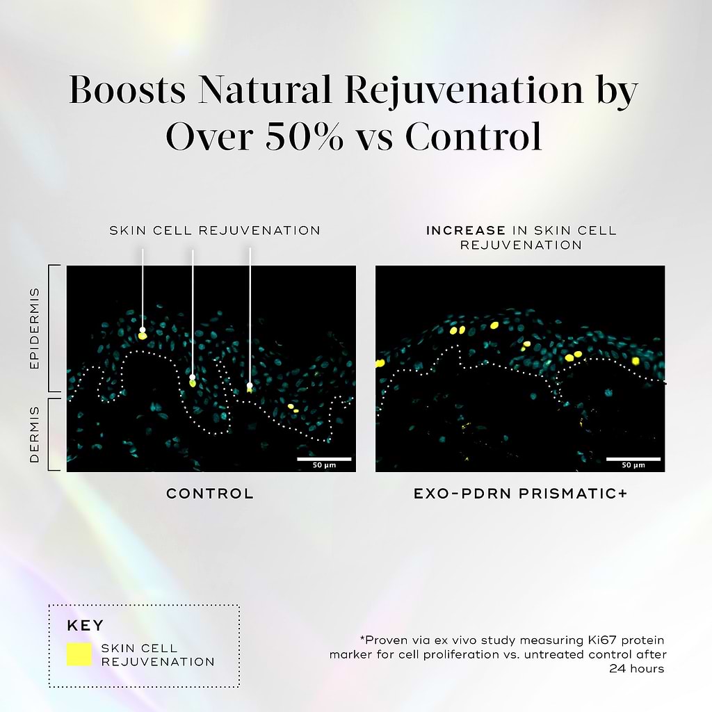 Scientific comparison of skin cell rejuvenation with and without Medik8 Exo-PDRN Prismatic+ serum, showing increased rejuvenation in the treated group.