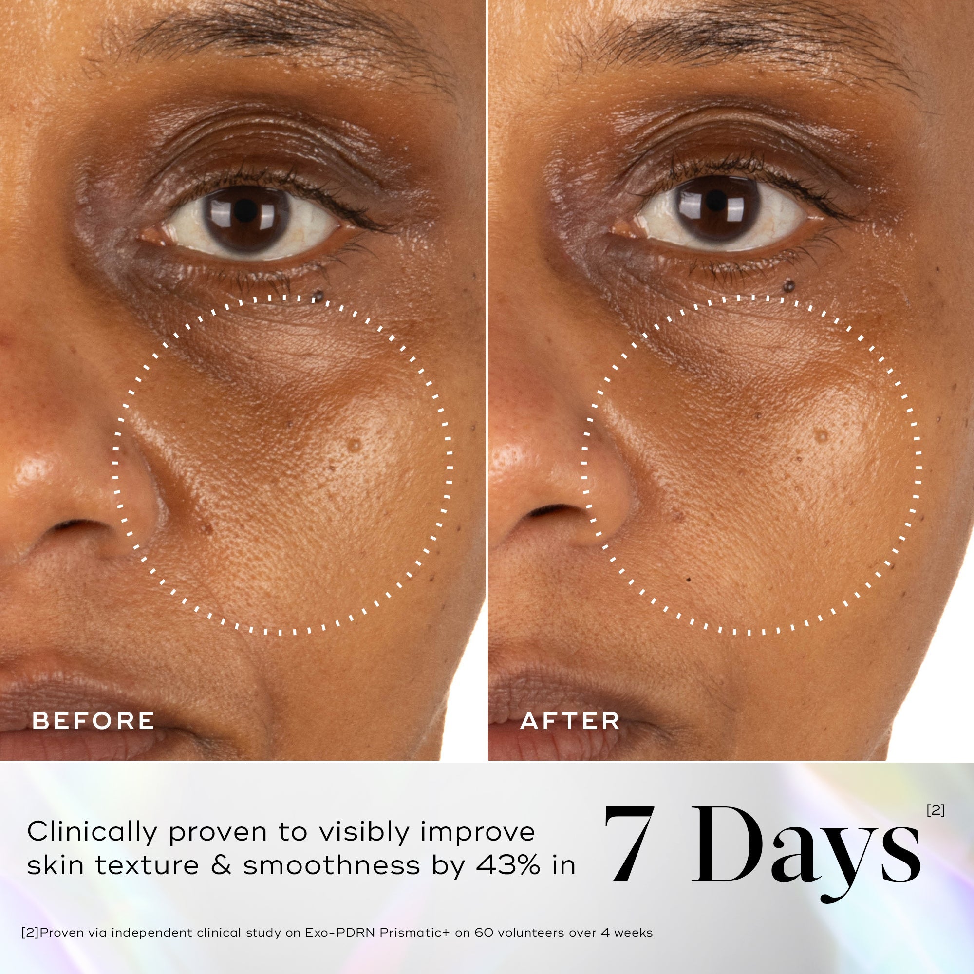 Before and after Medik8 Exo-PDRN Prismatic+ serum comparison of skin texture improvement on a person's face, with text indicating clinical proven results.