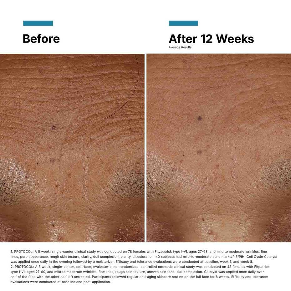 Close‑up before/after with HA Intensifier—smoother, brighter, hydrated, lifted skin.