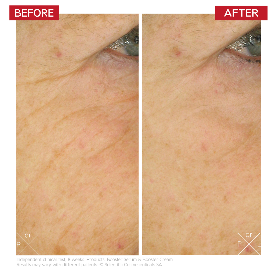 Before after images. Age-Reverse Stem Cell Cure products by Dr. LEVY Switzerland, intensive anti-ageing routine for smoother, firmer, radiant skin.