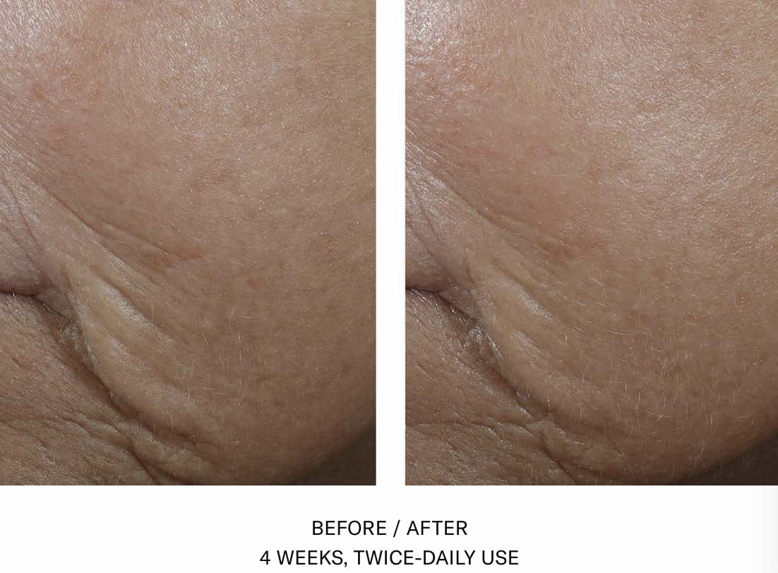 InterFuse Treatment Cream FACE & NECK Before after SkinBetter Science. Official UK Stockist. Worldwide shipping. Medical-grade skincare. The M-ethod Aesthetics
