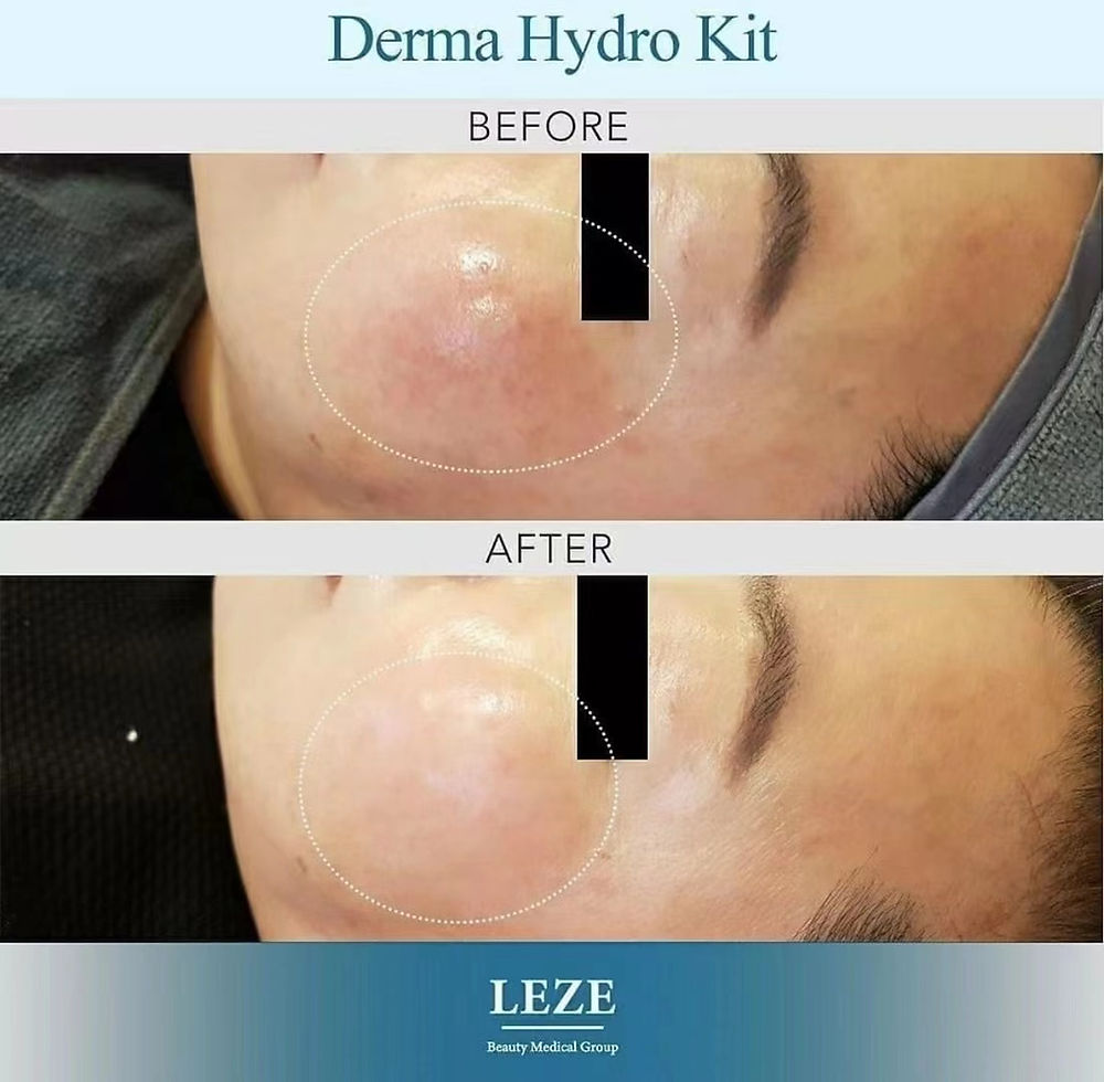 Derma Hydro PLUS Kit. Coslab Leze Korean Mediceuticals. The M-ethod Aesthetics. Worldwide Shipping.