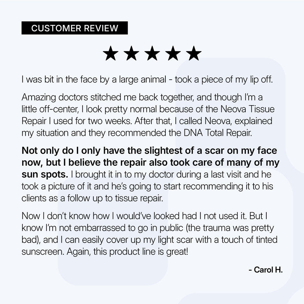 Customer review text of Neova Cu3 Tissue Repair with a five-star rating on a pale blue background. The review is from Carol H.