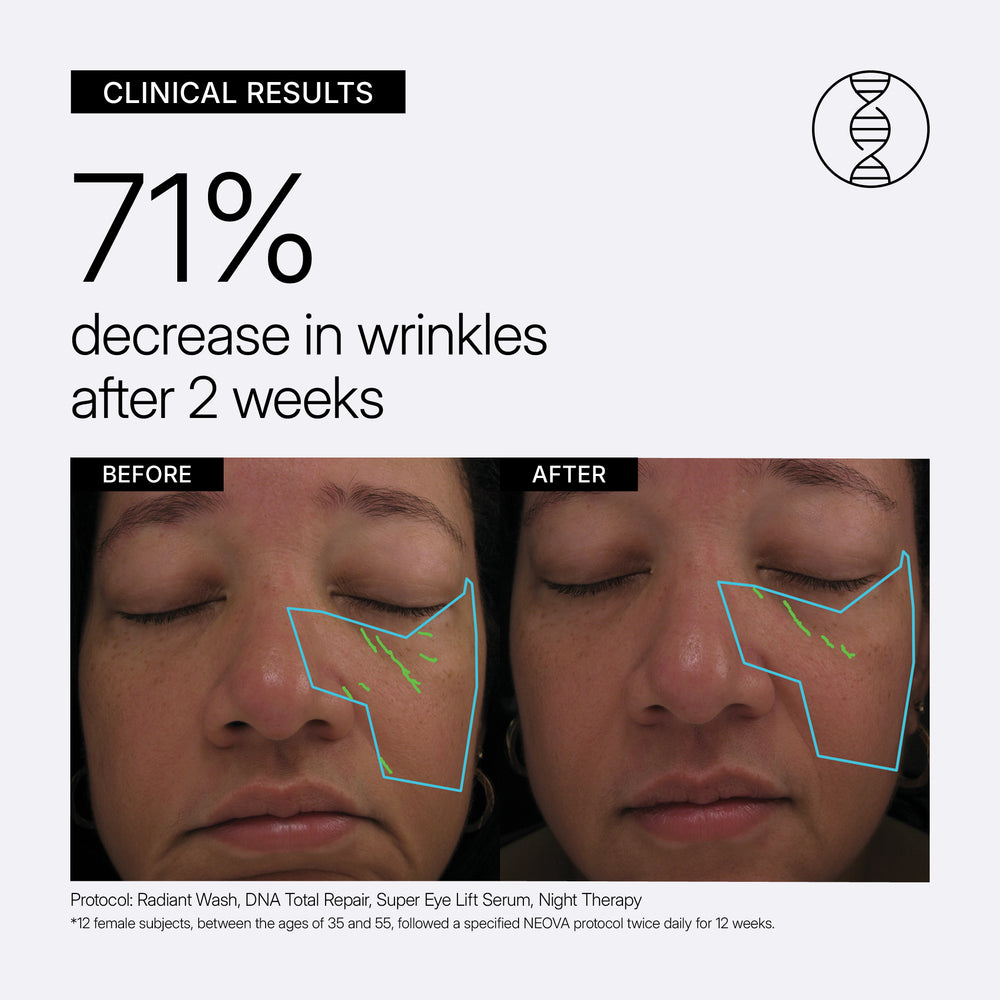 Clinical results graphic with use of DNA Total Repair, Night Therapy, showing a 71% decrease in wrinkles after 2 weeks, with a before-and-after comparison of a woman's eye area and small text detailing the skincare protocol.
