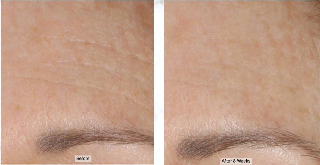 AlphaRet Overnight Cream Before After. SkinBetter Science. Official stockist. Worldwide delivery.